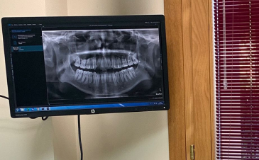 Trattamenti odontoiatrici a Piazzola sul Brenta e Marsango- Ortopantomografia