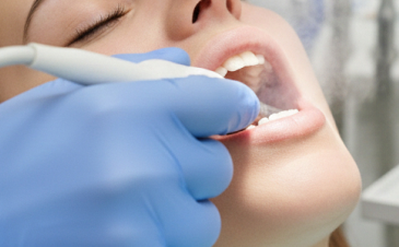 Trattamenti odontoiatrici a Piazzola sul Brenta e Marsango - Ozonoterapia Dentale