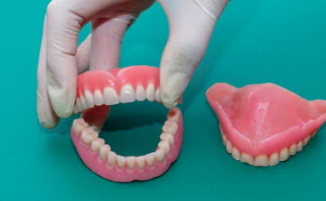 Trattamenti odontoiatrici a Piazzola sul Brenta e Marsango - Protesi Dentaria